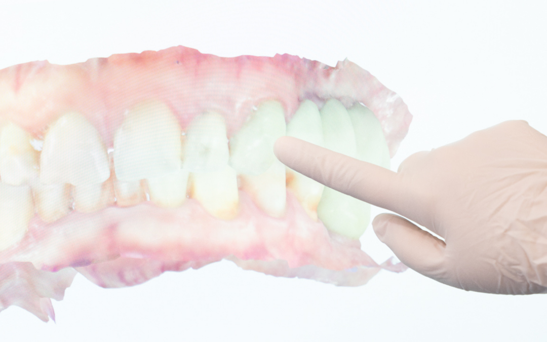 Diseño Digital de Sonrisa y Rehabilitación Oral Integral en Jerez